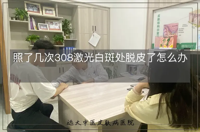 照了几次308激光白斑处脱皮了怎么办