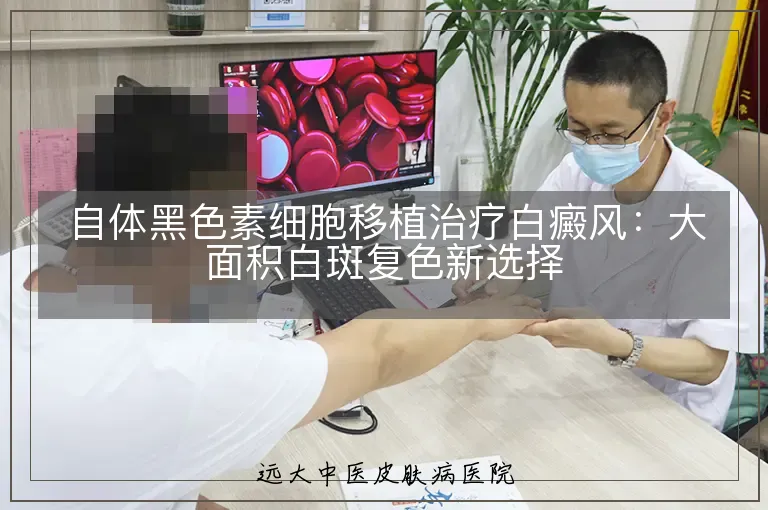 自体黑色素细胞移植治疗白癜风:大面积白斑复色新选择