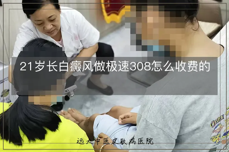 21岁长白癜风做极速308怎么收费的