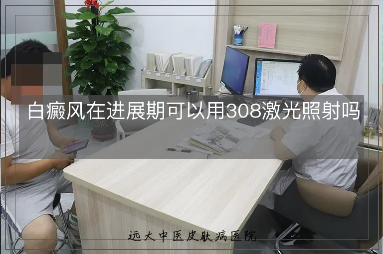 白癜风在进展期可以用308激光照射吗