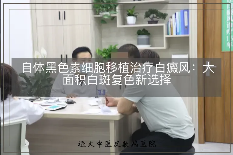 自体黑色素细胞移植治疗白癜风：大面积白斑复色新选择