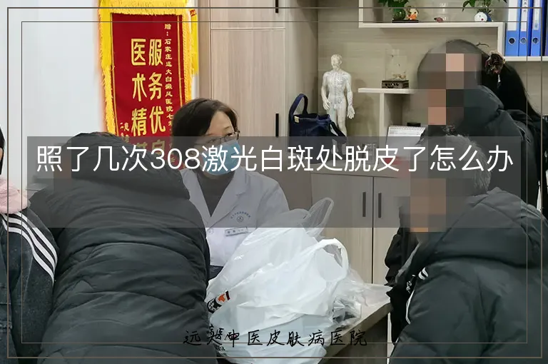 照了几次308激光白斑处脱皮了怎么办