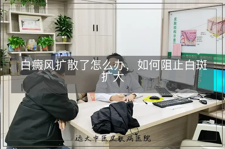 白癜风扩散了怎么办，如何阻止白斑扩大