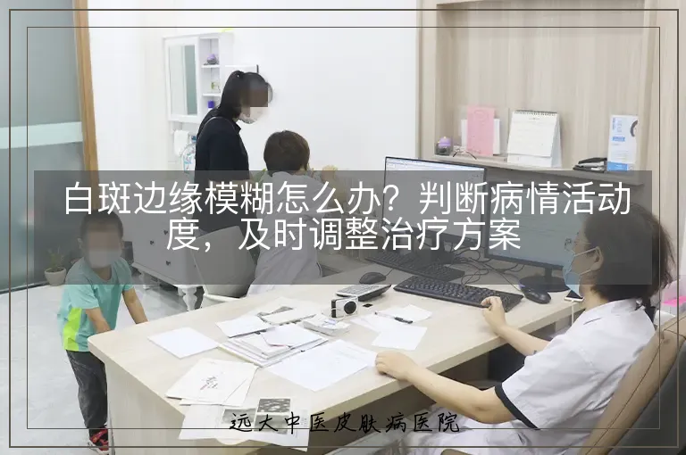 白斑边缘模糊怎么办?判断病情活动度,及时调整治疗方案