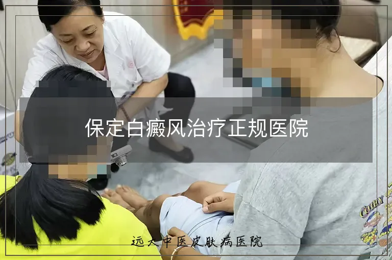 保定白癜风治疗正规医院