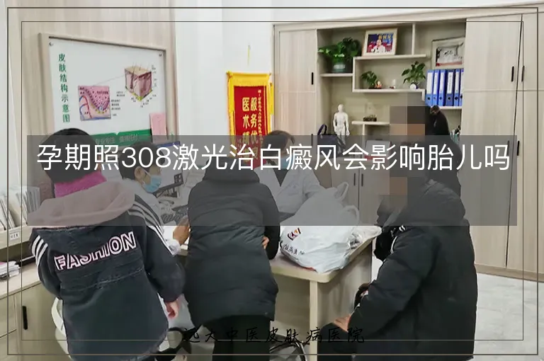 孕期照308激光治白癜风会影响胎儿吗