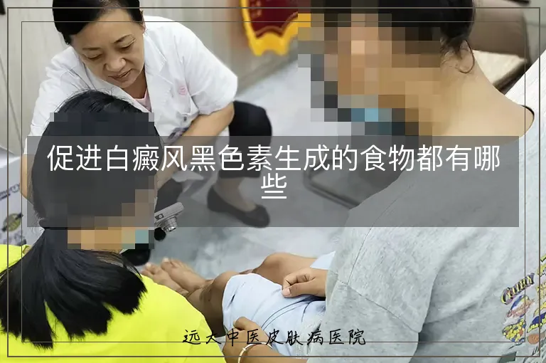 促进白癜风黑色素生成的食物都有哪些