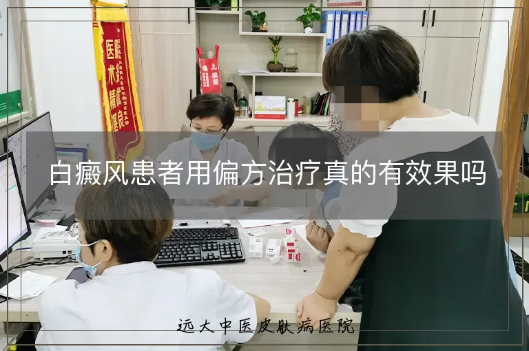白癜风患者用偏方治疗真的有效果吗