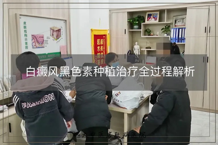 白癜风黑色素种植治疗全过程解析