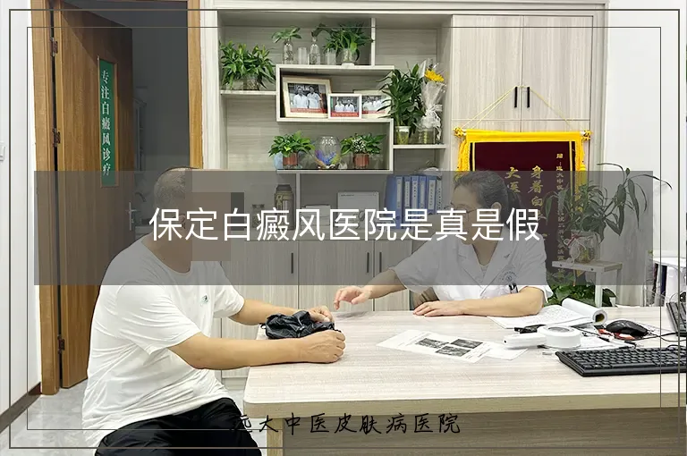 保定白癜风医院是真是假