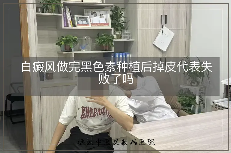 白癜风做完黑色素种植后掉皮代表失败了吗