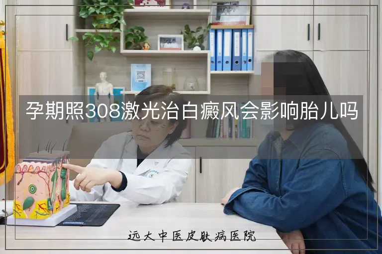 孕期照308激光治白癜风会影响胎儿吗