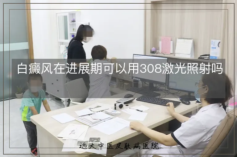 白癜风在进展期可以用308激光照射吗