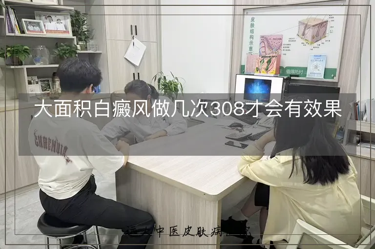 大面积白癜风做几次308才会有效果