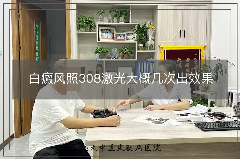 白癜风照308激光大概几次出效果