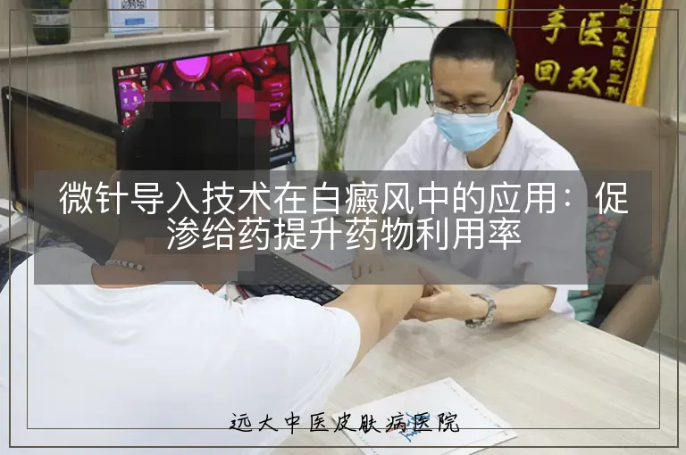 微针导入技术在白癜风中的应用:促渗给药提升药物利用率