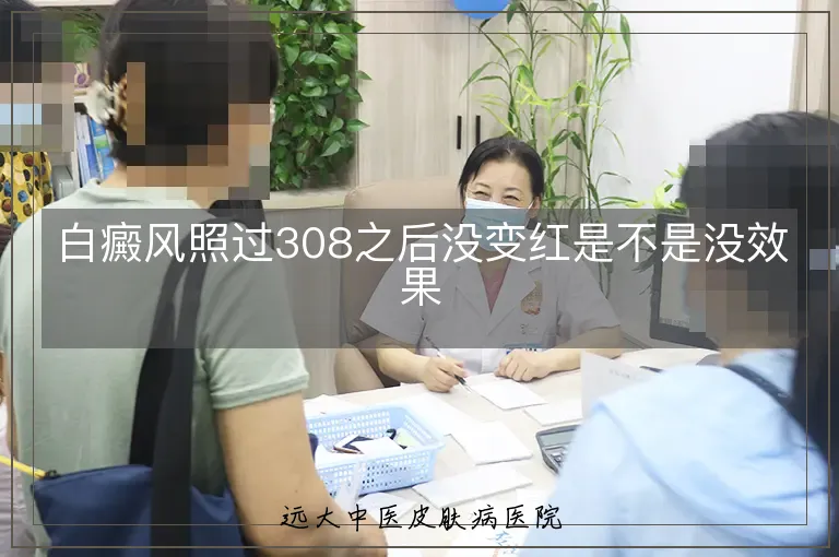 白癜风照过308之后没变红是不是没效果