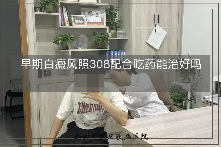 早期白癜风照308配合吃药能治好吗