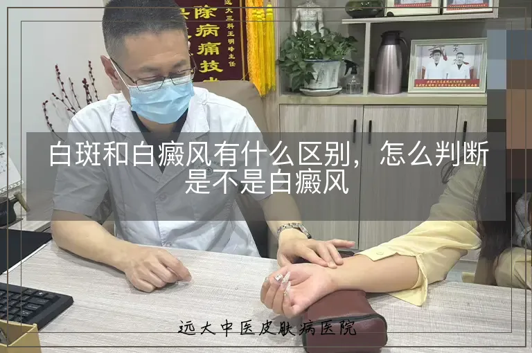 白斑和白癜风有什么区别,怎么判断是不是白癜风