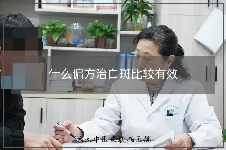 什么偏方治白斑比较有效