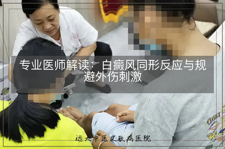 专业医师解读:白癜风同形反应与规避外伤刺激