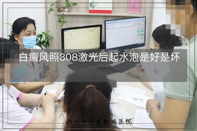 白癜风照308激光后起水泡是好是坏