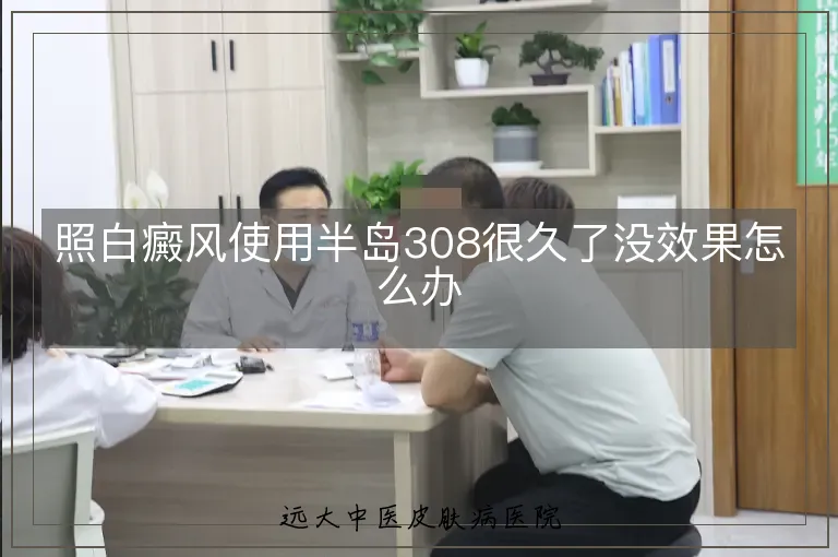 照白癜风使用半岛308很久了没效果怎么办