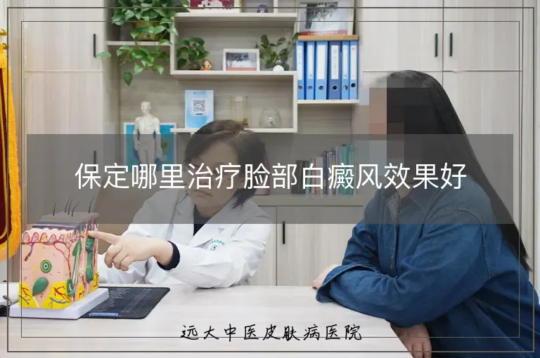 保定哪里治疗脸部白癜风效果好