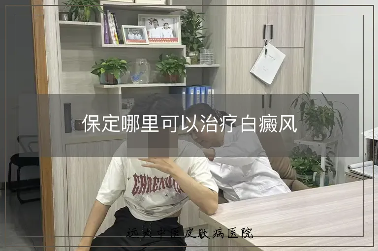 保定哪里可以治疗白癜风