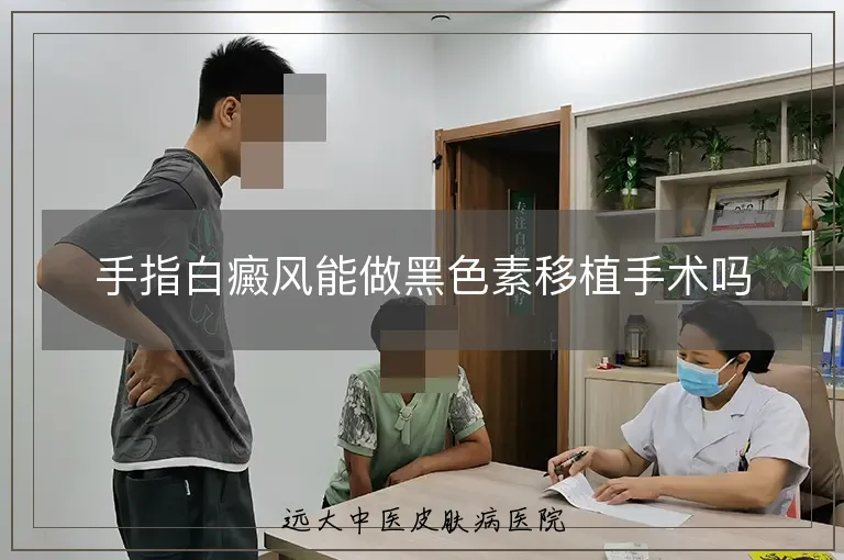 手指白癜风能做黑色素移植手术吗