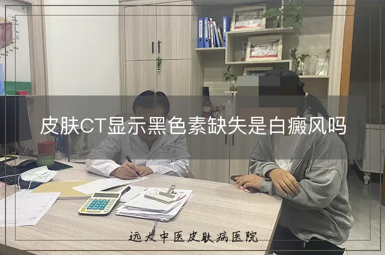 皮肤CT显示黑色素缺失是白癜风吗