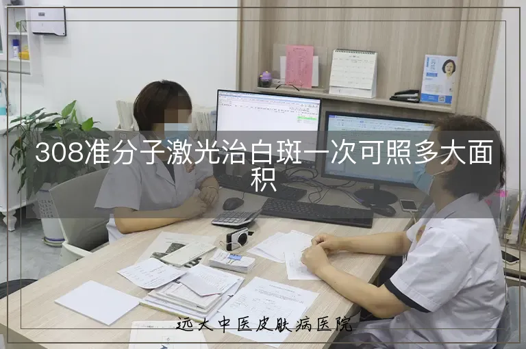 308准分子激光治白斑一次可照多大面积