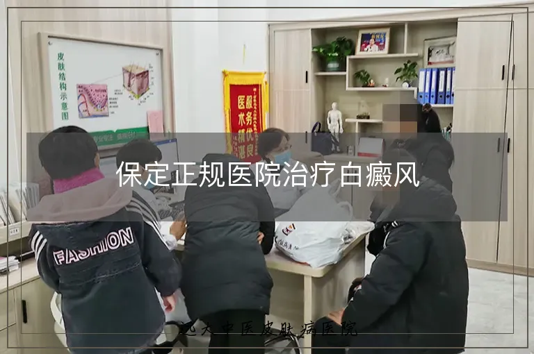保定正规医院治疗白癜风