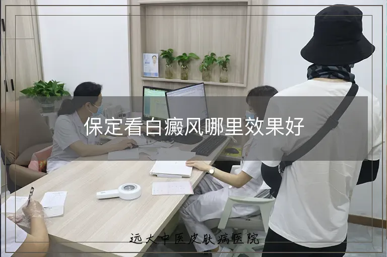 保定看白癜风哪里效果好