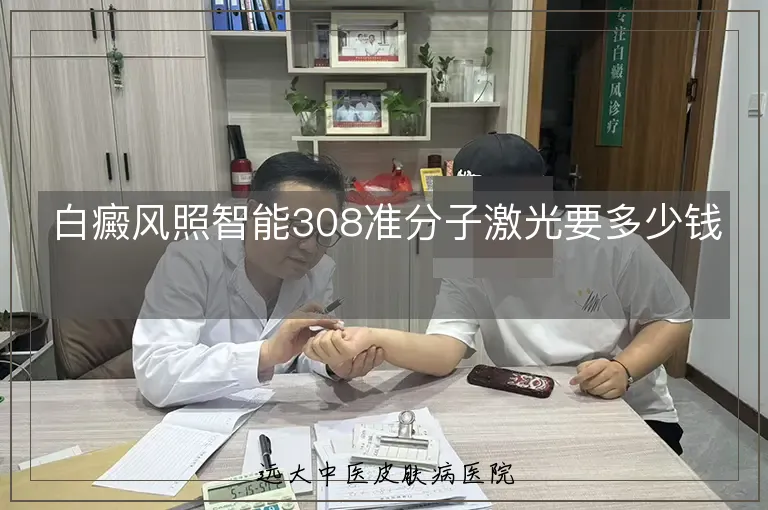 白癜风照智能308准分子激光要多少钱