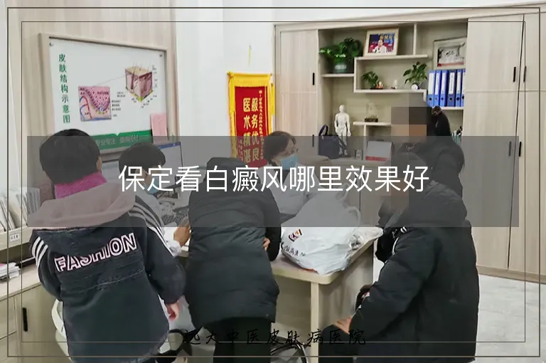 保定看白癜风哪里效果好