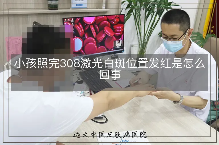 小孩照完308激光白斑位置发红是怎么回事