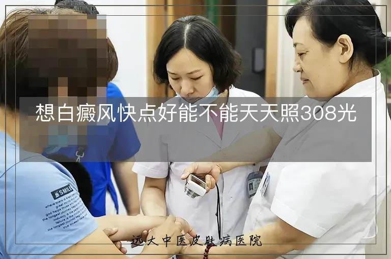 想白癜风快点好能不能天天照308光
