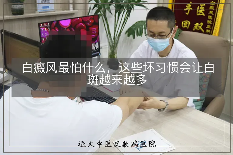 白癜风最怕什么，这些坏习惯会让白斑越来越多
