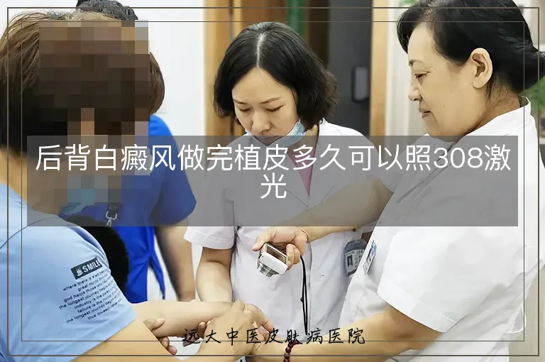 后背白癜风做完植皮多久可以照308激光