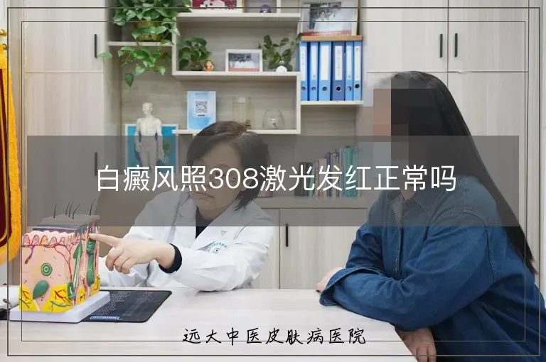 白癜风照308激光发红正常吗