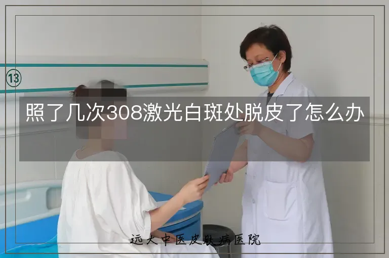 照了几次308激光白斑处脱皮了怎么办