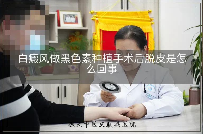 白癜风做黑色素种植手术后脱皮是怎么回事
