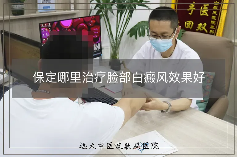 保定哪里治疗脸部白癜风效果好