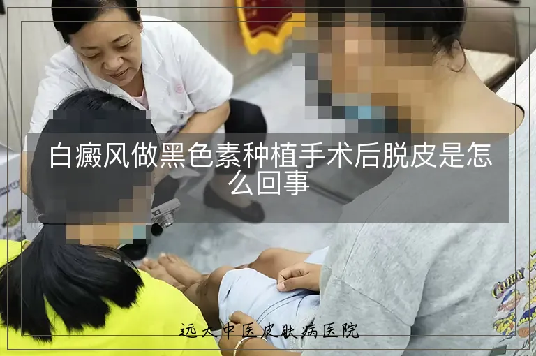 白癜风做黑色素种植手术后脱皮是怎么回事