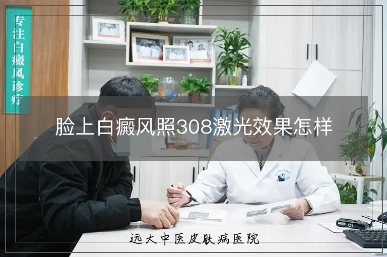 脸上白癜风照308激光效果怎样