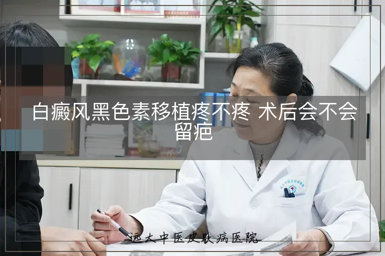白癜风黑色素移植疼不疼 术后会不会留疤