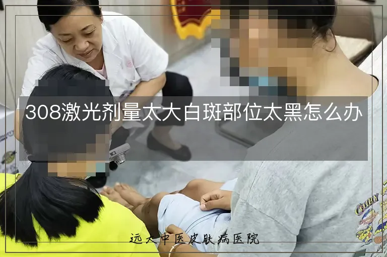 308激光剂量太大白斑部位太黑怎么办