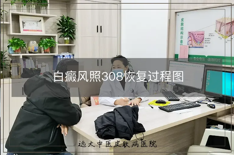 白癜风照308恢复过程图