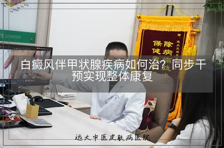白癜风伴甲状腺疾病如何治?同步干预实现整体康复